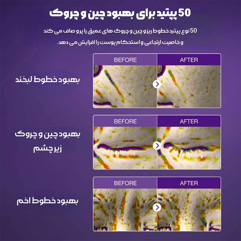 اسنس بایو لیفتینگ نامبر 9 نامبوزین
