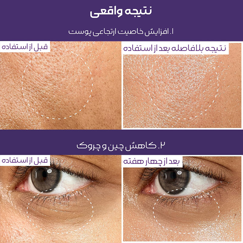 اسنس بایو لیفتینگ نامبر 9 نامبوزین